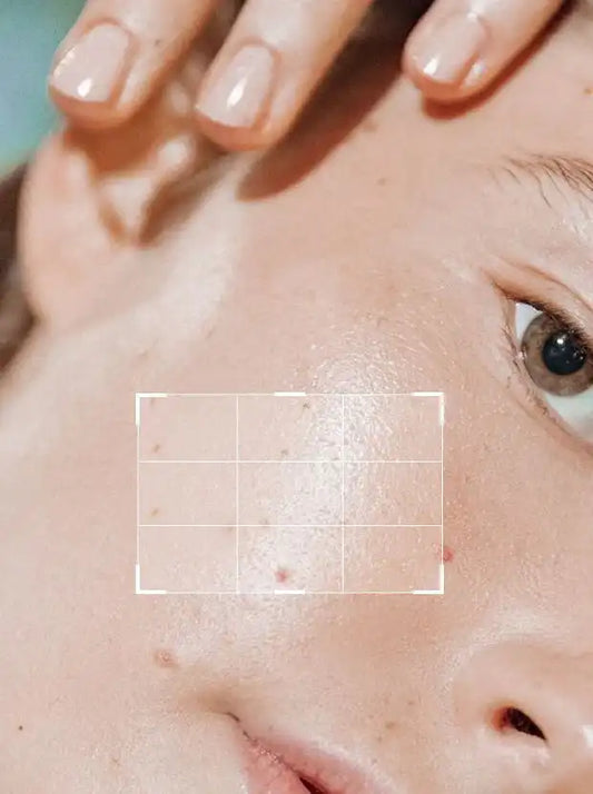 Niacinamide serum 10 % + ZINC 30 ml